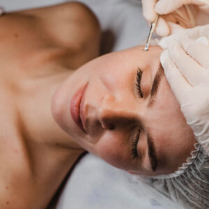 Dermapen Microneedling