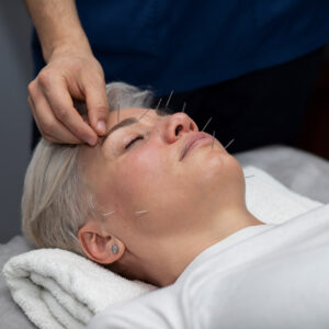 Curso de Lifting Facial con Acupuntura