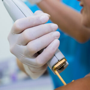 Eliminación de Tatuajes con Tecnología Láser